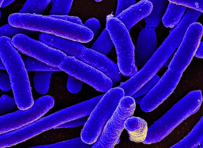 E. coli provoacă cel mai adesea dezvoltarea cistitei la femei